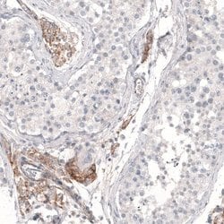 THSD7A Antibody (CL3778), Novus Biologicals 25 &mu;L | Buy Online | Novus Biologicals | Fisher Scientific