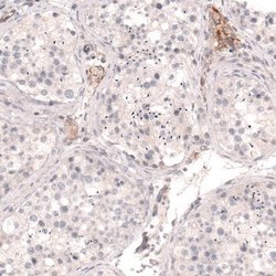 THSD7A Antibody (CL3779), Novus Biologicals:Antibodies:Primary Antibodies