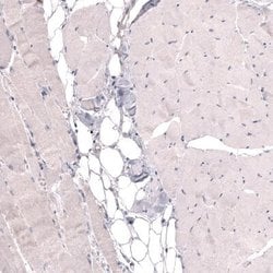 THSD7A Antibody (CL3779), Novus Biologicals:Antibodies:Primary Antibodies