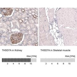 THSD7A Antibody (CL3779), Novus Biologicals:Antibodies:Primary Antibodies