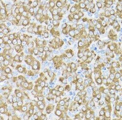 THUMPD3 Antibody - BSA Free, Novus Biologicals 0.02 mL, Unconjugated:Antibodies,