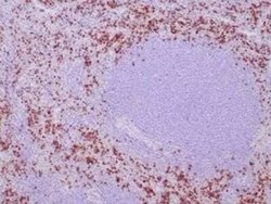 TIA1 Rabbit anti-Human, Clone: TIA1/1352R, Novus Biologicals 20 &mu;g;