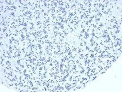 TIA1 Rabbit anti-Human, Clone: TIA1/1352R, Novus Biologicals 20 &mu;g;