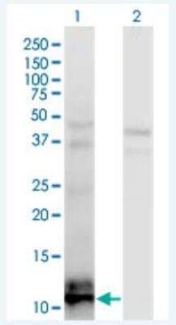 TIAF1 Antibody (3B9), Novus Biologicals 100 &mu;g | Buy Online | Novus Biologicals | Fisher Scientific
