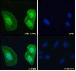 TIAM1 Antibody, Novus Biologicals 100 &mu;g; Unconjugated:Antibodies, Polyclonal