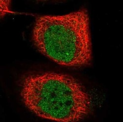 TICRR Antibody, Novus Biologicals 25ul; Unconjugated:Antibodies, Polyclonal