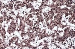 TIF1 gamma Antibody, Novus Biologicals 100 &mu;g | Buy Online | Novus Biologicals | Fisher Scientific