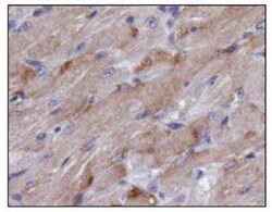 TIGAR/C12orf5 Antibody - BSA Free, Novus Biologicals:Antibodies:Primary