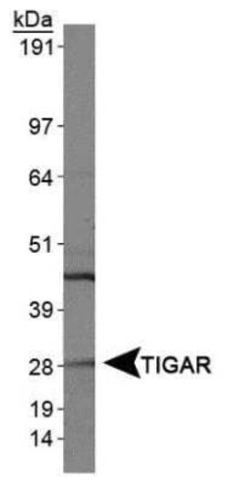 TIGAR/C12orf5 Antibody - BSA Free, Novus Biologicals:Antibodies:Primary