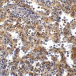 TIGIT Antibody (2C7) - VHH - Azide and BSA Free, Novus Biologicals 0.1 mg | Buy Online | Novus Biologicals | Fisher Scientific