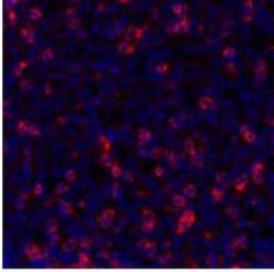 TIGIT Antibody (BLR047F), Novus Biologicals 100 &mu;g | Buy Online | Bio-Techne | Fisher Scientific