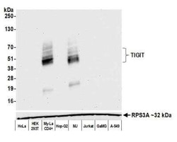 TIGIT Antibody (BLR047F), Novus Biologicals 100 &mu;g | Buy Online | Bio-Techne | Fisher Scientific