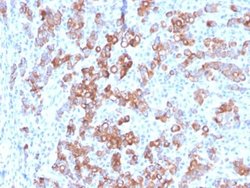 TIM-3, Mouse anti-Human, Clone: TIM3/3113, Novus Biologicals 100 ug; Unconjugated:Antibodies,