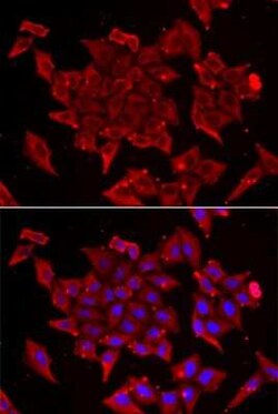 TIMM17A Antibody - BSA Free, Novus Biologicals:Antibodies:Primary Antibodies