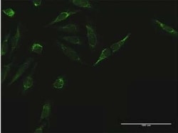 TIMM44 Antibody, Novus Biologicals 0.05 mg | Buy Online | Novus Biologicals | Fisher Scientific