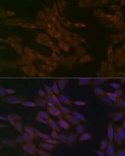 TIMM50 Rabbit anti-Human, Mouse, Rat, Clone: 0W6J4, Novus Biologicals 100 &mu;g | Buy Online | Novus Biologicals | Fisher Scientific