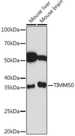 TIMM50 Rabbit anti-Human, Mouse, Rat, Clone: 0W6J4, Novus Biologicals 100 &mu;g | Buy Online | Novus Biologicals | Fisher Scientific