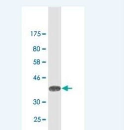 TIMM8A Antibody (2D12), Novus Biologicals 0.1 mg | Buy Online | Novus Biologicals | Fisher Scientific