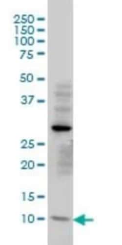TIMM8A Antibody (2F11), Novus Biologicals 0.1 mg | Buy Online | Novus Biologicals | Fisher Scientific