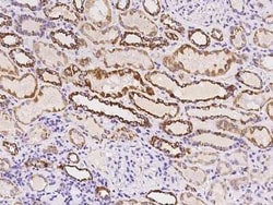 TIMM8A Antibody, Novus Biologicals:Antibodies:Primary Antibodies