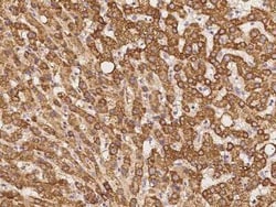 TIMM8A Antibody, Novus Biologicals:Antibodies:Primary Antibodies