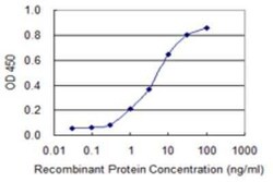 TIMM8B Antibody (3C8), Novus Biologicals 0.1 mg | Buy Online | Novus Biologicals | Fisher Scientific