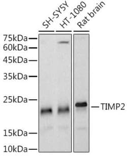 TIMP-2 Rabbit anti-Human, Mouse, Rat, Monkey, Clone: 8R5Q2, Novus Biologicals:Antibodies:Primary