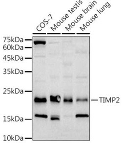 TIMP-2 Rabbit anti-Human, Mouse, Rat, Monkey, Clone: 8R5Q2, Novus Biologicals:Antibodies:Primary