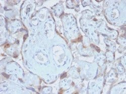 TIMP-2 Rabbit anti-Human, Mouse, Rat, Bovine, Guinea Pig, Rabbit, Zebrafish,