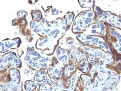 TIMP-2 Antibody (3A4), Novus Biologicals:Antibodies:Primary Antibodies