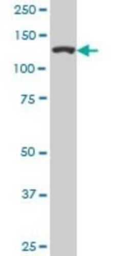 TIP120A Antibody (1G5), Novus Biologicals 0.1 mg | Buy Online | Novus Biologicals | Fisher Scientific