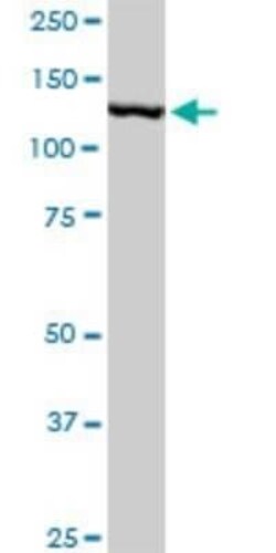 TIP120A Antibody (1G5), Novus Biologicals 0.1 mg | Buy Online | Novus Biologicals | Fisher Scientific