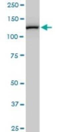 TIP120A Antibody (2D7), Novus Biologicals 0.1 mg | Buy Online | Novus Biologicals | Fisher Scientific