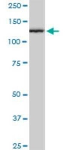 TIP120A Antibody (2D7), Novus Biologicals 0.1 mg | Buy Online | Novus Biologicals | Fisher Scientific