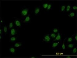 TIP120A Antibody (5D7), Novus Biologicals 0.1 mg | Buy Online | Novus Biologicals | Fisher Scientific