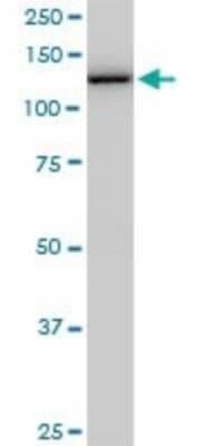 TIP120A Antibody (5F2), Novus Biologicals 0.1 mg | Buy Online | Novus Biologicals | Fisher Scientific