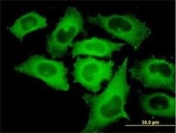 TIPIN Antibody (1G11), Novus Biologicals 0.1 mg | Buy Online | Novus Biologicals | Fisher Scientific