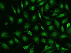 TIPIN Antibody, Novus Biologicals 50 &mu;g, Unconjugated:Antibodies, Polyclonal