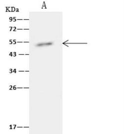 TIPIN Antibody, Novus Biologicals 50 &mu;g, Unconjugated:Antibodies, Polyclonal