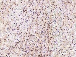 TIPRL Antibody, Novus Biologicals 100 &mu;g, Unconjugated:Antibodies, Polyclonal