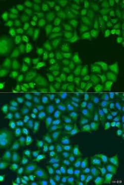 TIRAP Antibody - BSA Free, Novus Biologicals:Antibodies:Primary Antibodies
