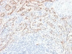 TL1A/TNFSF15 Rabbit anti-Human, Clone: VEGI/2052R, Novus Biologicals:Antibodies:Primary