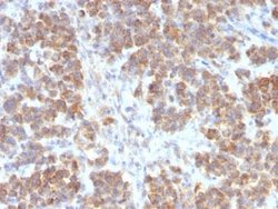 TL1A/TNFSF15 Rabbit anti-Human, Clone: VEGI/2052R, Novus Biologicals:Antibodies:Primary