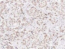 TLE1 Antibody, Novus Biologicals 100 &mu;g | Buy Online | Novus Biologicals | Fisher Scientific