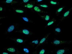 TLK1 Antibody, Novus Biologicals 50 &mu;g, Unconjugated:Antibodies, Polyclonal