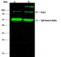 TLK1 Antibody, Novus Biologicals 50 &mu;g, Unconjugated:Antibodies, Polyclonal