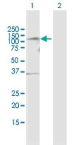 TLK1 Antibody, Novus Biologicals 0.05 mg | Buy Online | Novus Biologicals | Fisher Scientific