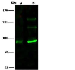 TLK1 Antibody, Novus Biologicals 50 &mu;g, Unconjugated:Antibodies, Polyclonal
