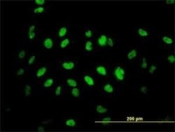 TLK2 Antibody (2G7), Novus Biologicals 0.1 mg | Buy Online | Novus Biologicals | Fisher Scientific
