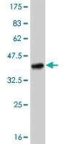 TLR8 Antibody (4C6), Novus Biologicals 0.1 mg | Buy Online | Novus Biologicals | Fisher Scientific